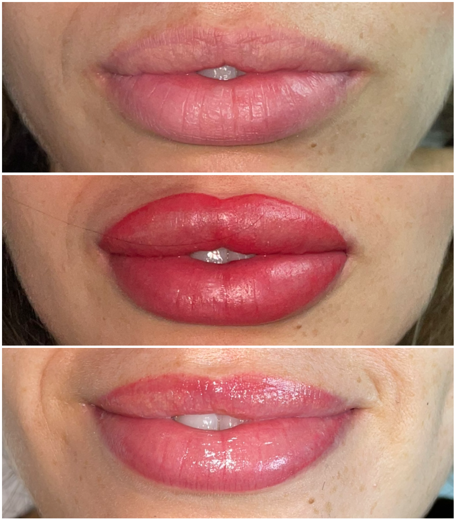 Labios · Evolución del color